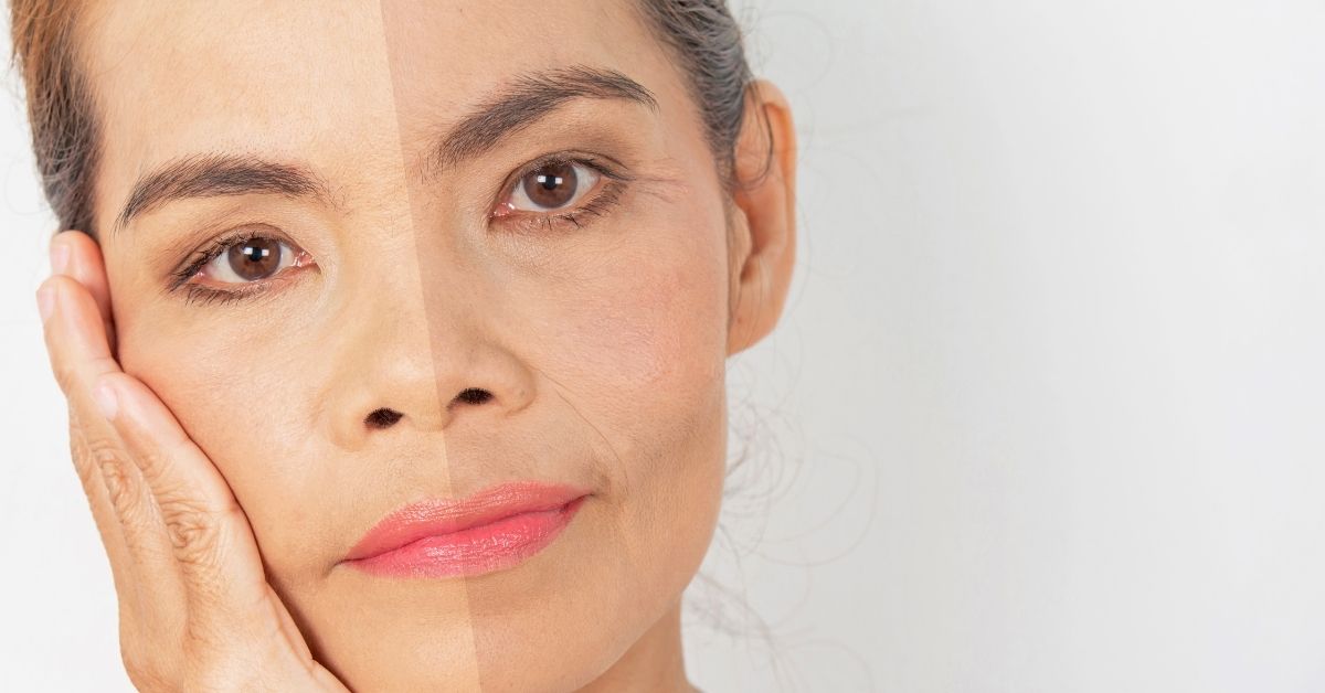 Como amenizar o Aspeto de cansaço da Pele