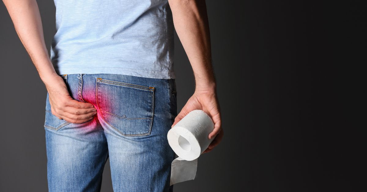 Descubra as melhores maneiras de prevenir e tratar hemorroidas externas