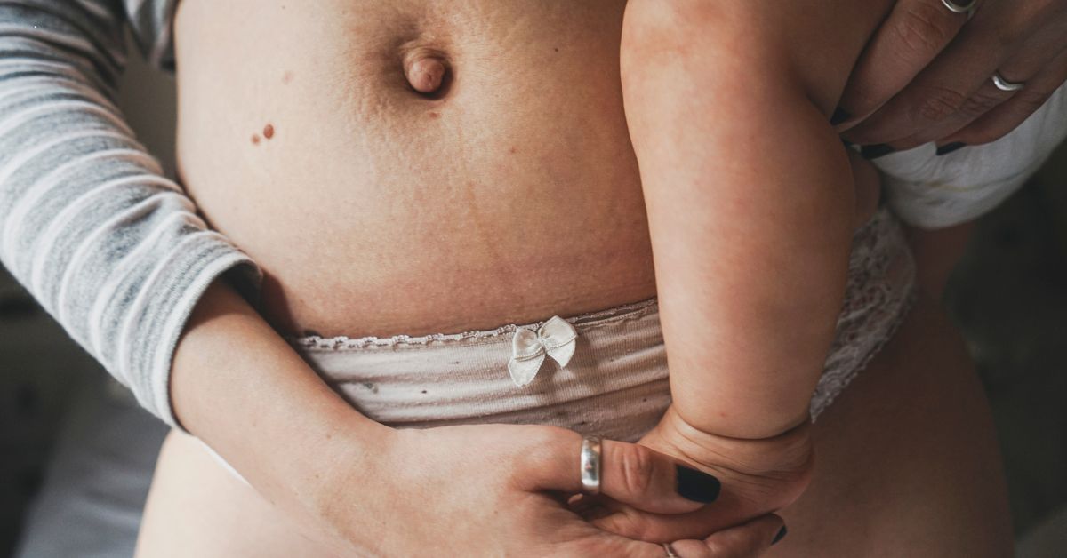 Episiotomia: Tudo o Que Precisa de Saber e Como Cuidar